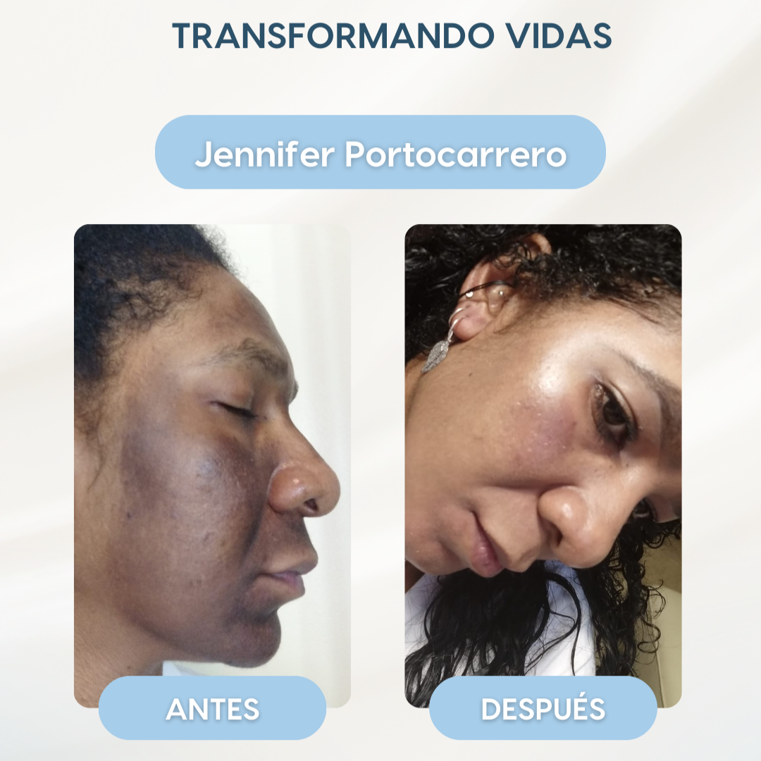 Kit Anti Manchas Faciales