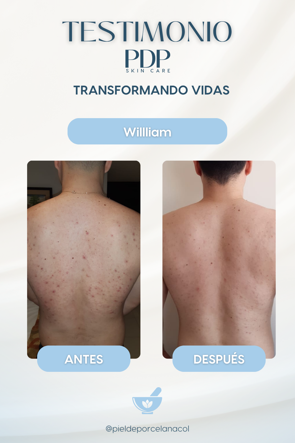 Kit Bye Bye Foliculitis