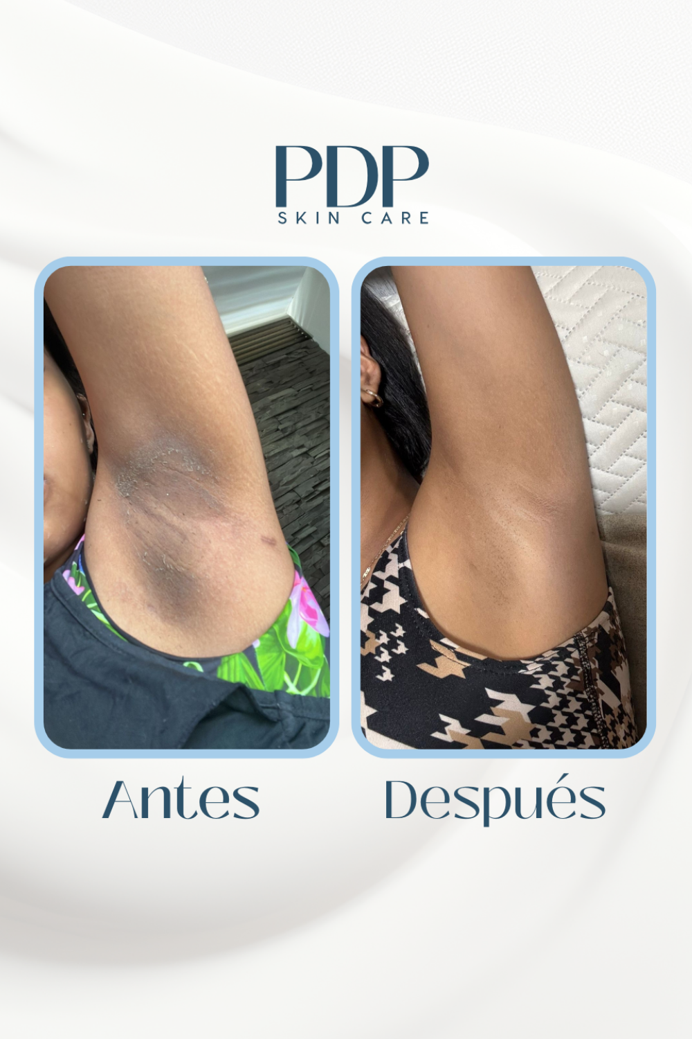 Tonico Anti Manchas Faciales y Corporales