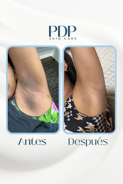 Tonico Anti Manchas Faciales y Corporales