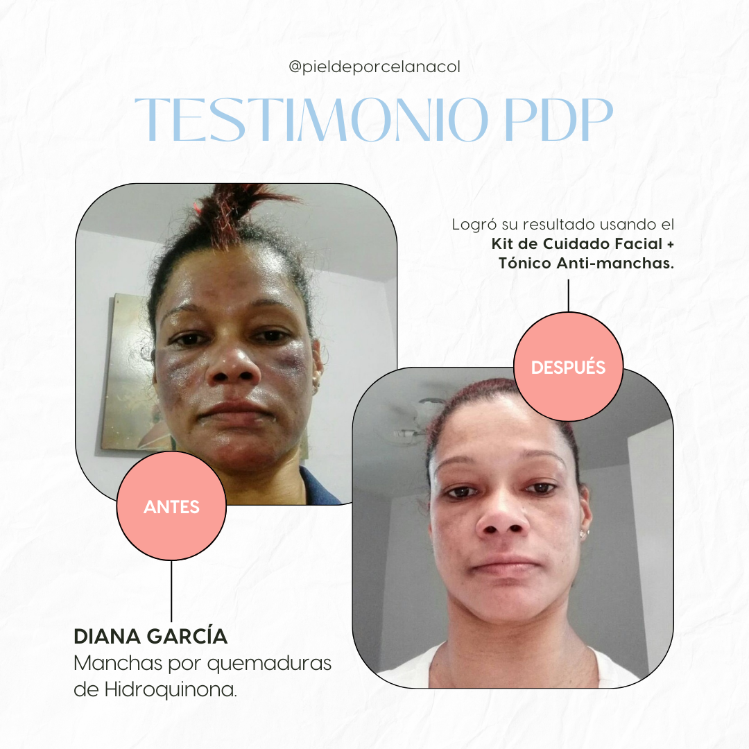 Kit Anti Manchas Pro