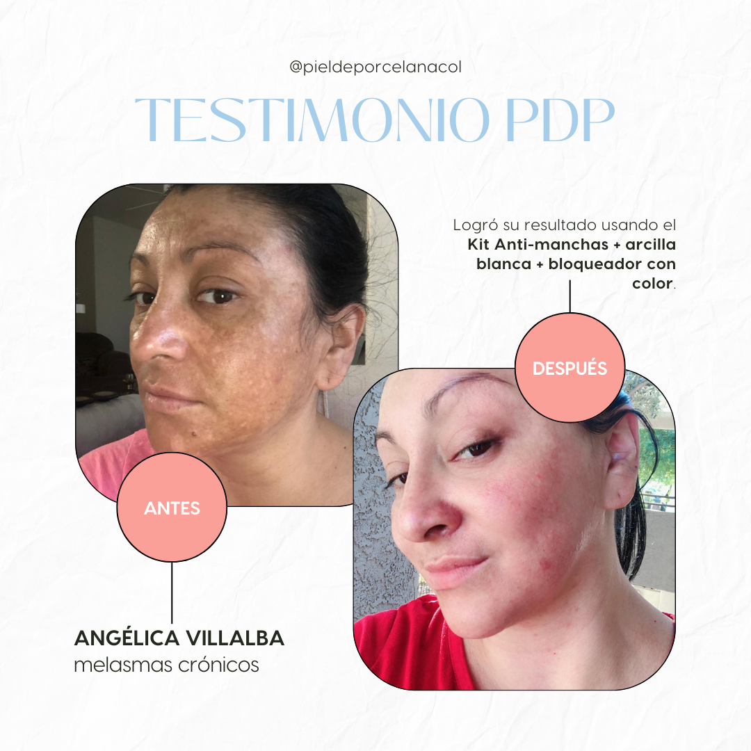 Kit Anti Manchas Pro