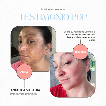 Kit Anti Manchas Pro