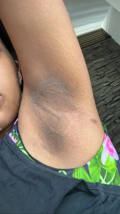 Tonico Dermoreparador Facial y Corporal