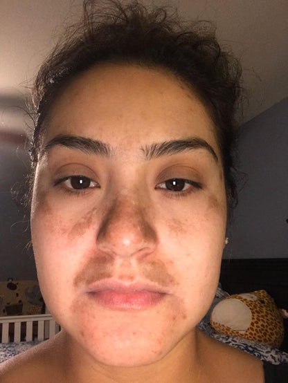 Tonico Dermoreparador Facial y Corporal