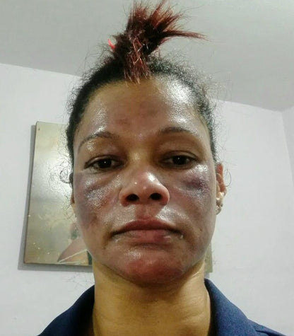 Tonico Dermoreparador Facial y Corporal