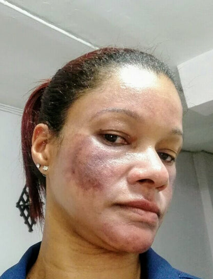 Tonico Dermoreparador Facial y Corporal