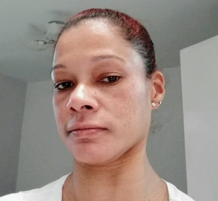 Tonico Dermoreparador Facial y Corporal